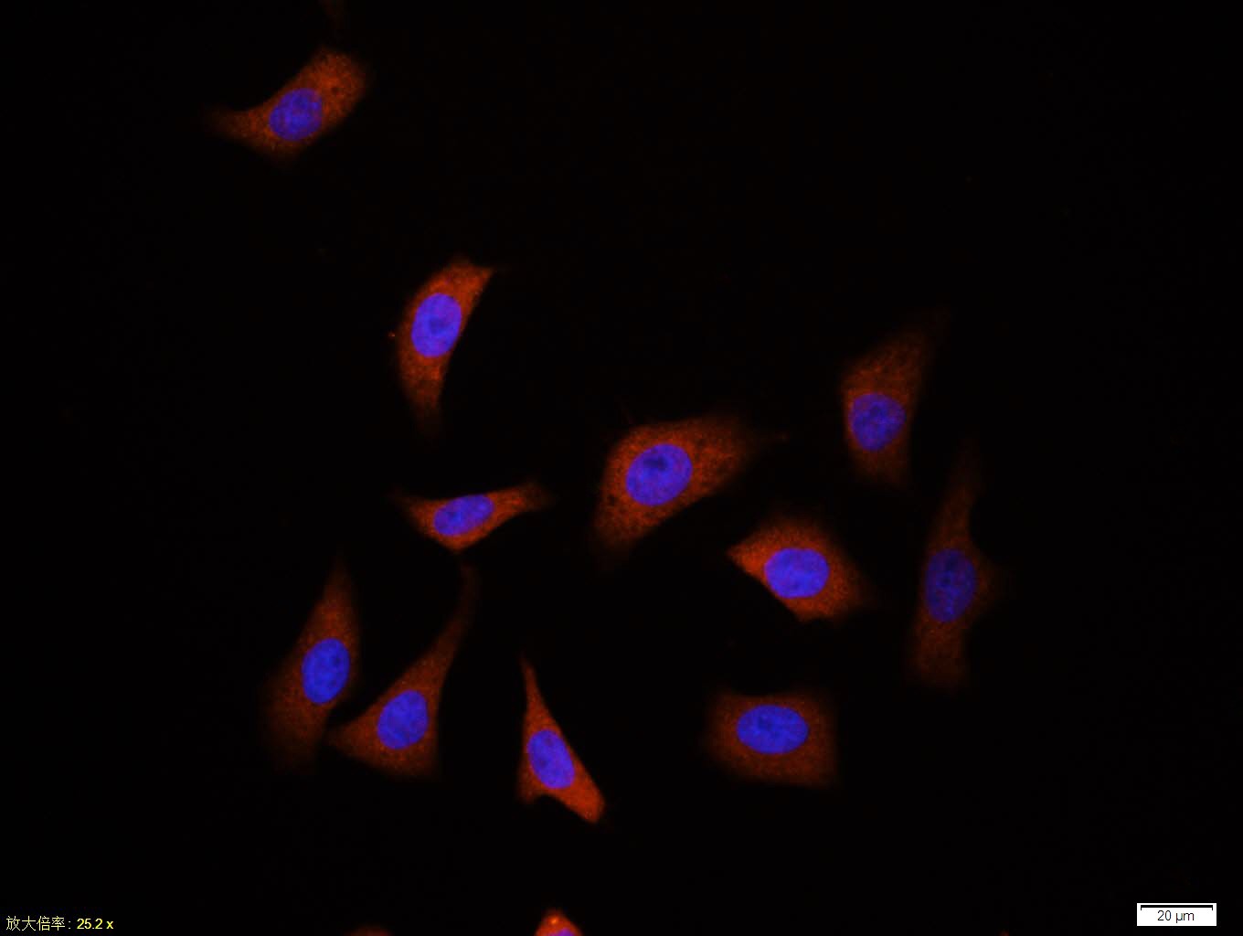 Anti-Ubiquitin Antibody (5H931)