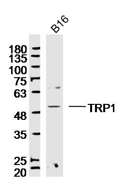Anti-TYRP1 Polyclonal Antibody
