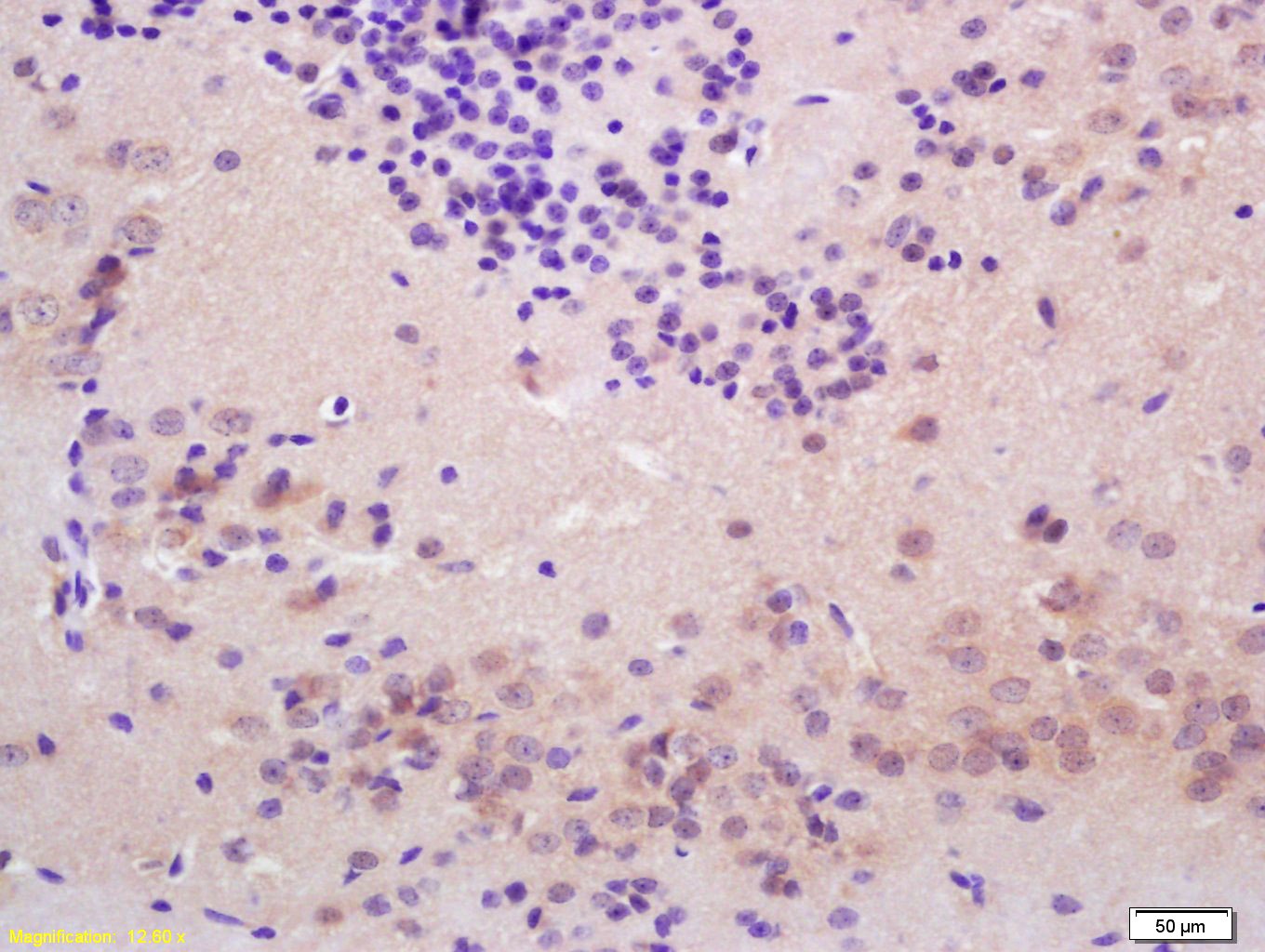 Anti-Thyroid peroxidase Polyclonal Antibody