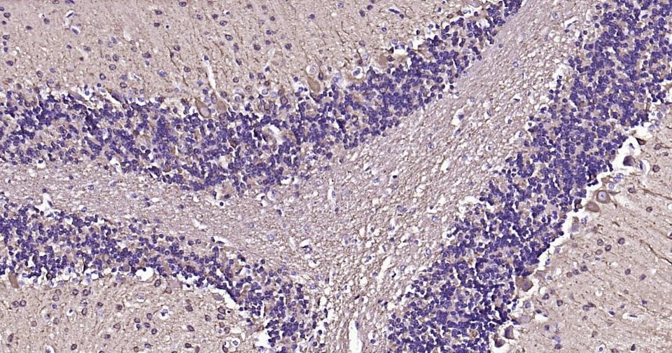 Anti-TUBB3 Antibody (3P633)