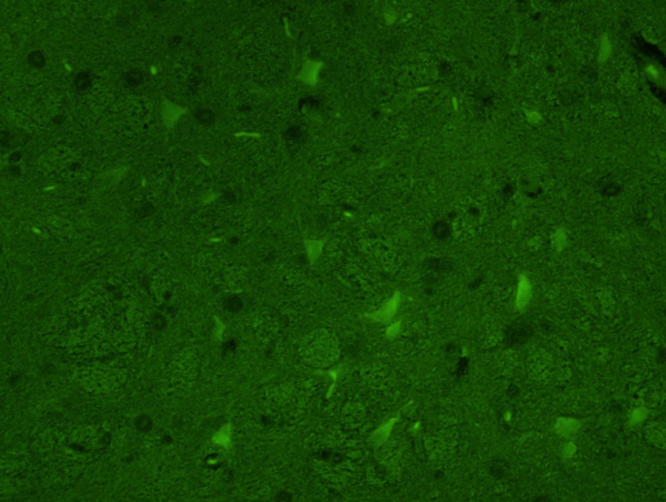 Anti-Tyrosine Hydroxylase Polyclonal Antibody