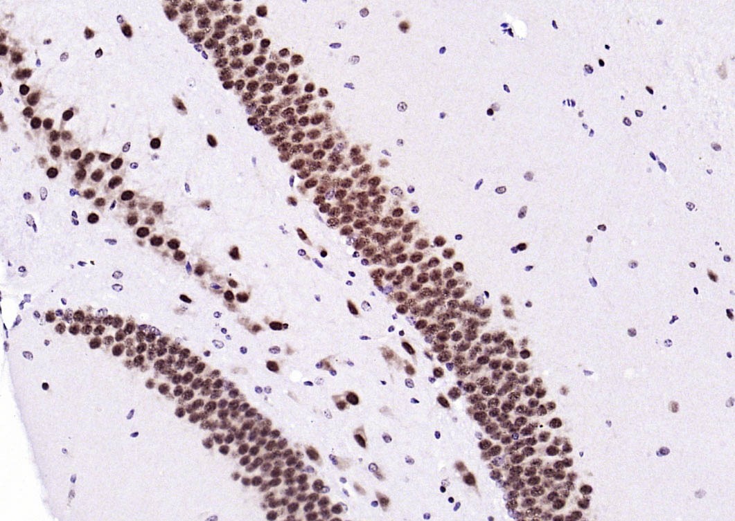 Anti-Ubiquitin Antibody (5H931)