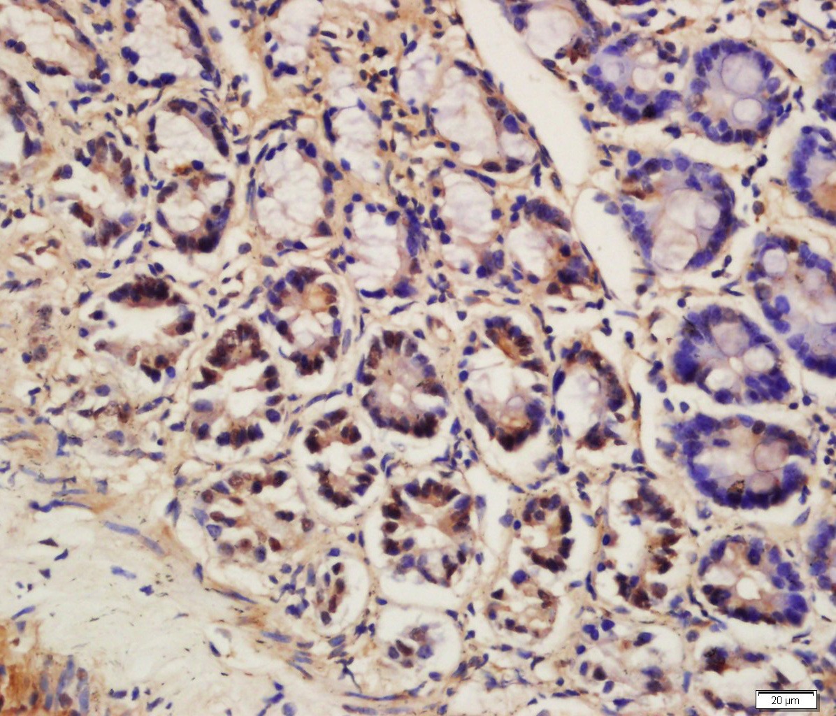Anti-Ubiquitin Polyclonal Antibody