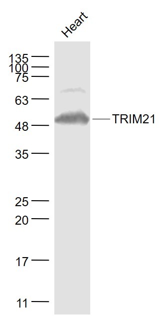 Anti-TRIM21 Polyclonal Antibody