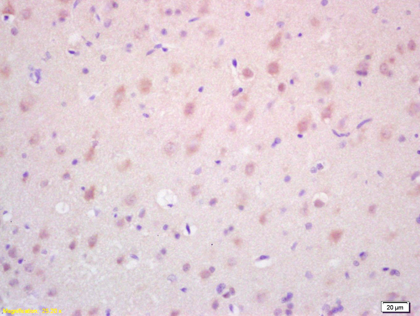 Anti-TAK1 Polyclonal Antibody