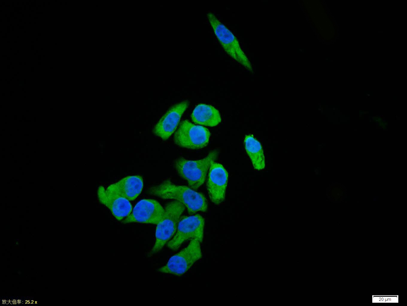 Anti-UCP2 Polyclonal Antibody