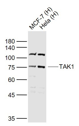 Anti-TAK1 Polyclonal Antibody
