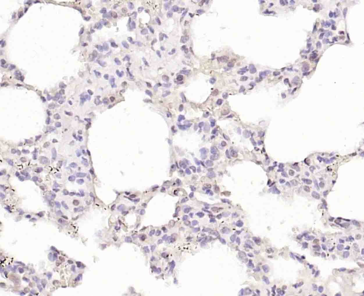 Anti-TRIM21 Polyclonal Antibody