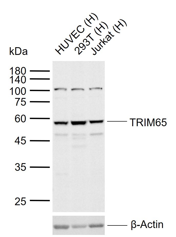 Anti-TRIM65 Polyclonal Antibody