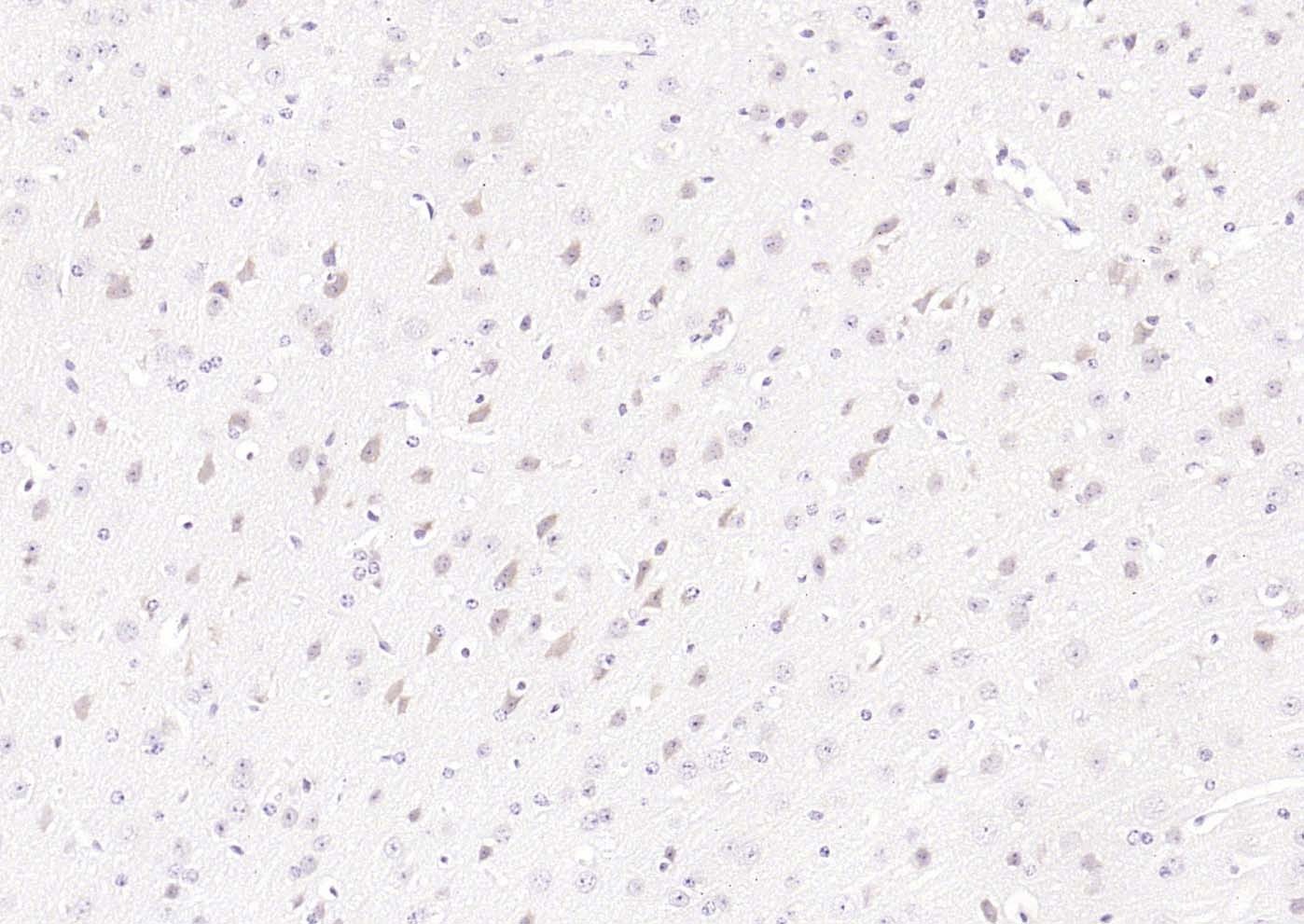 Anti-UCHL1 Polyclonal Antibody