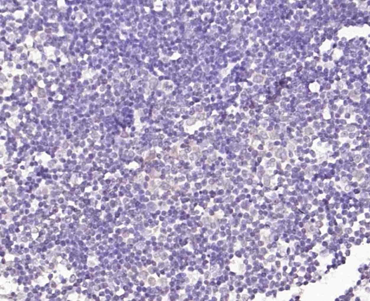 Anti-TRIM21 Polyclonal Antibody