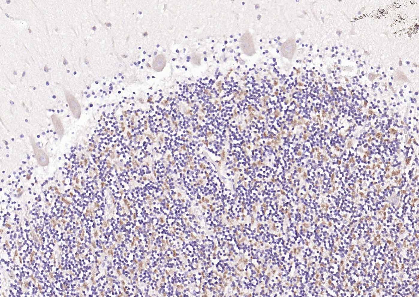 Anti-UCHL1 Polyclonal Antibody