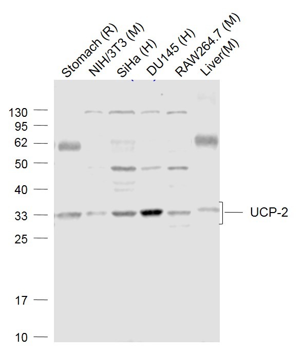 Anti-UCP2 Polyclonal Antibody