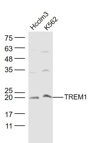Anti-TREM-1 Polyclonal Antibody