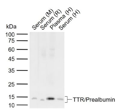 Anti-Transthyretin/Prealbumin Polyclonal Antibody