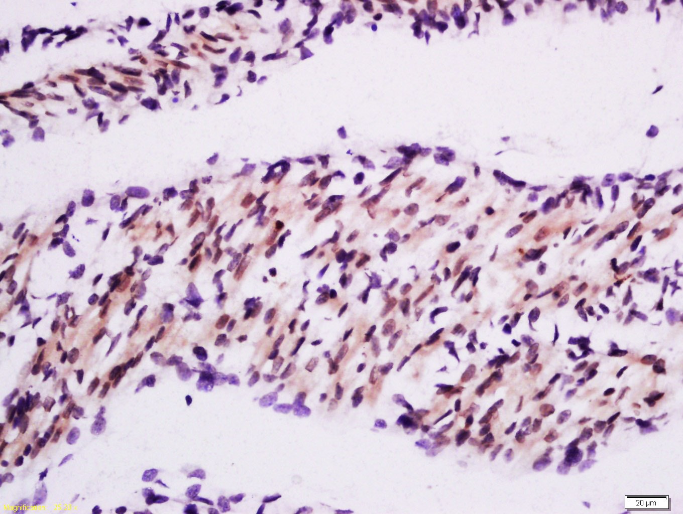 Anti-TRIM63 Polyclonal Antibody
