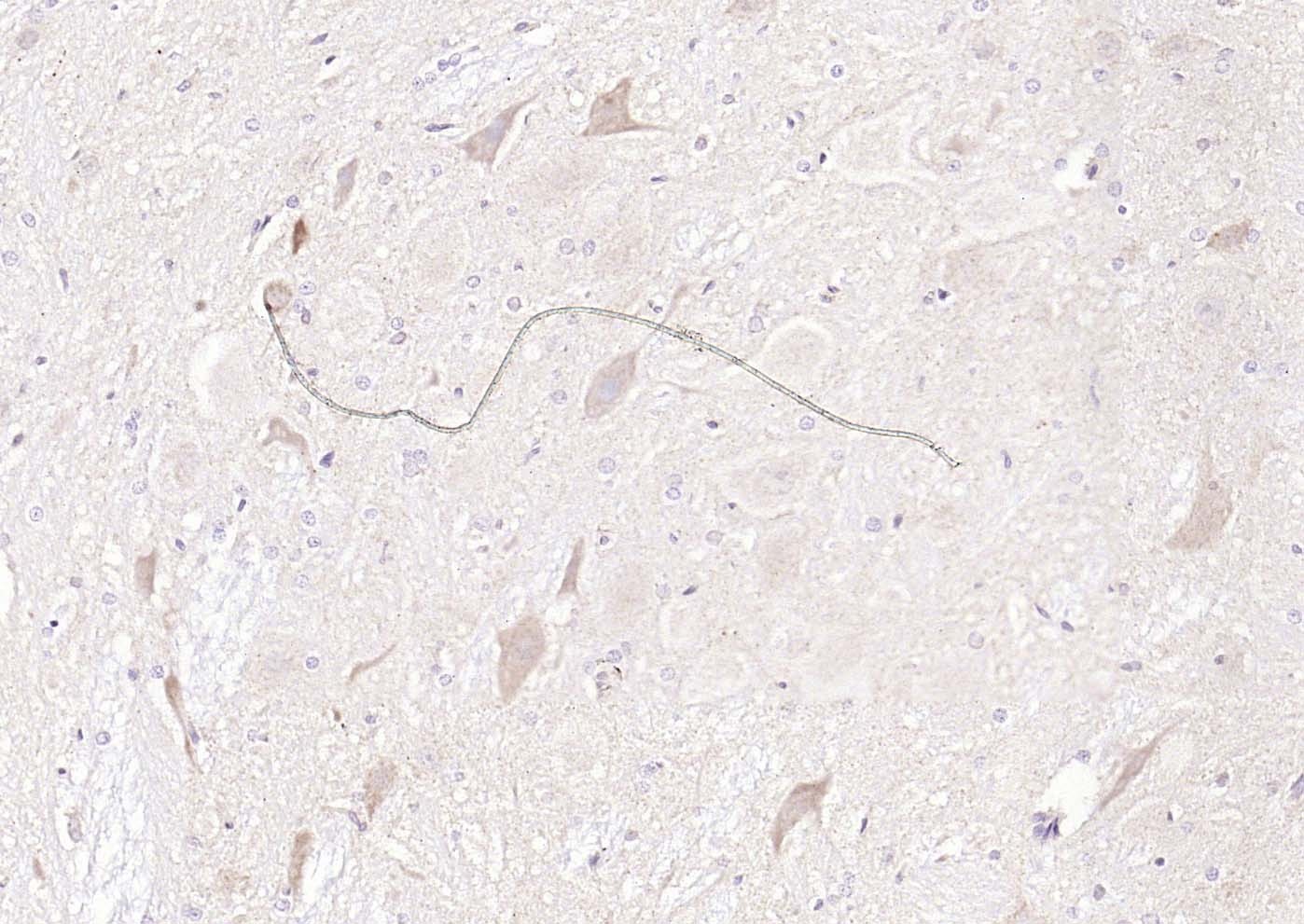 Anti-UCHL1 Polyclonal Antibody