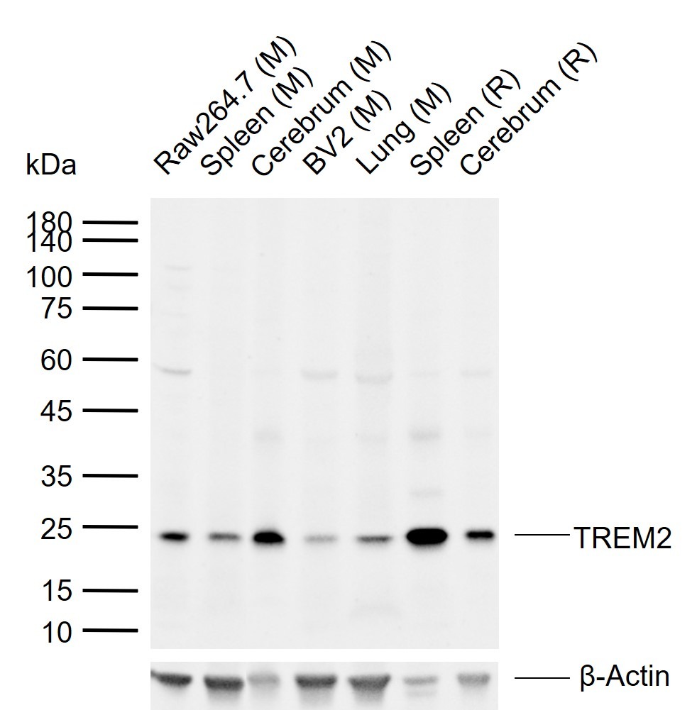 Anti-TREM-2 Polyclonal Antibody