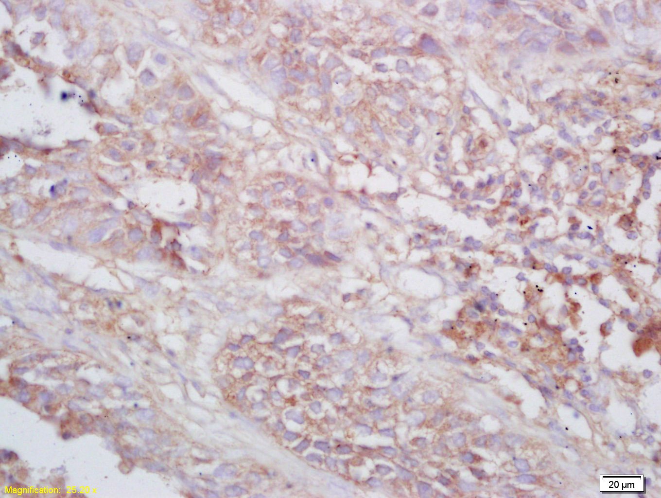 Anti-Tenomodulin Polyclonal Antibody