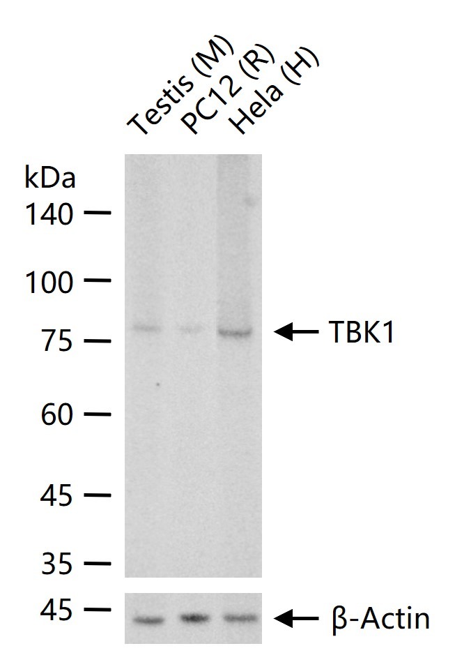 Anti-TBK1 Polyclonal Antibody