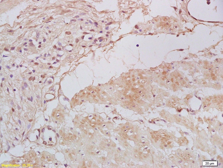 Anti-TBX21 Polyclonal Antibody