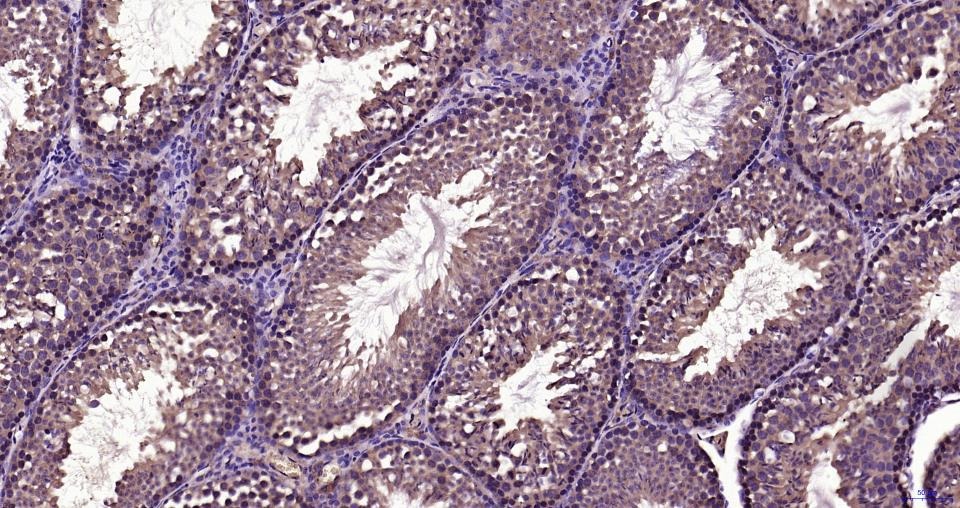 Anti-TBK1 Polyclonal Antibody