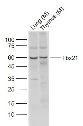 Anti-TBX21 Polyclonal Antibody