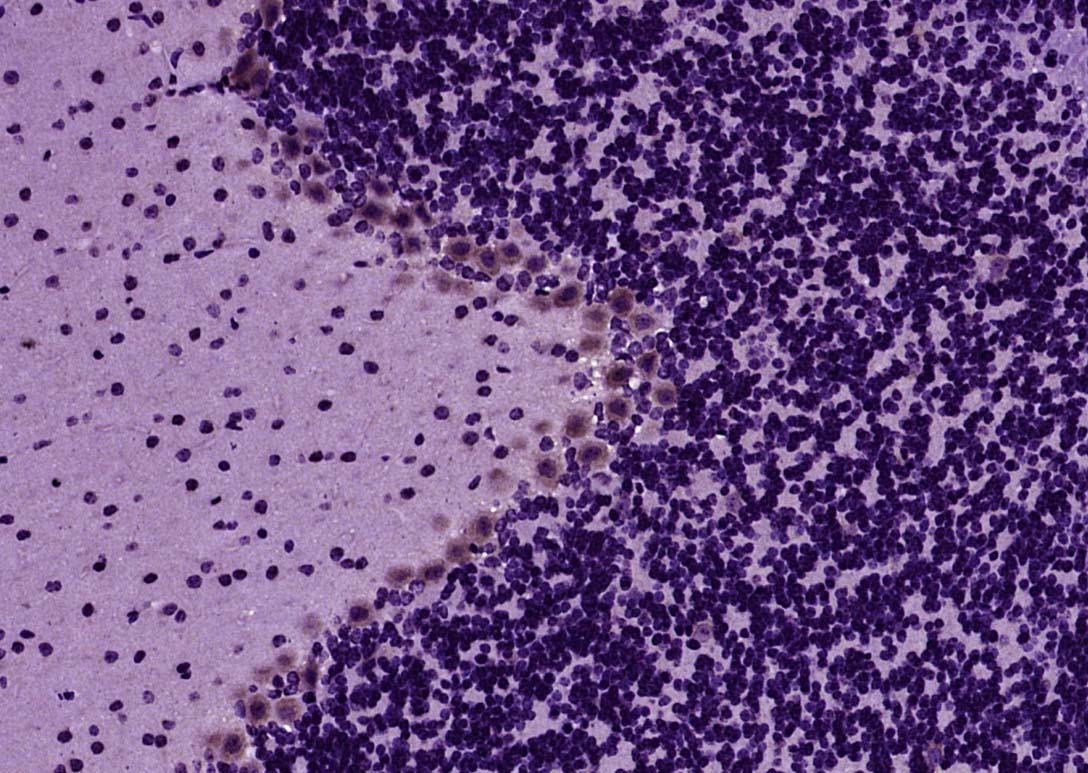 Anti-Tenascin Polyclonal Antibody 2