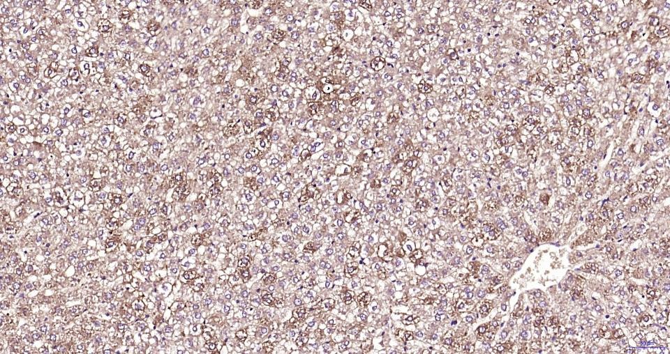 Anti-TBK1 Polyclonal Antibody