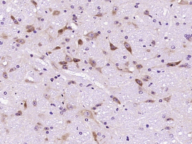 Anti-Uricase Polyclonal Antibody