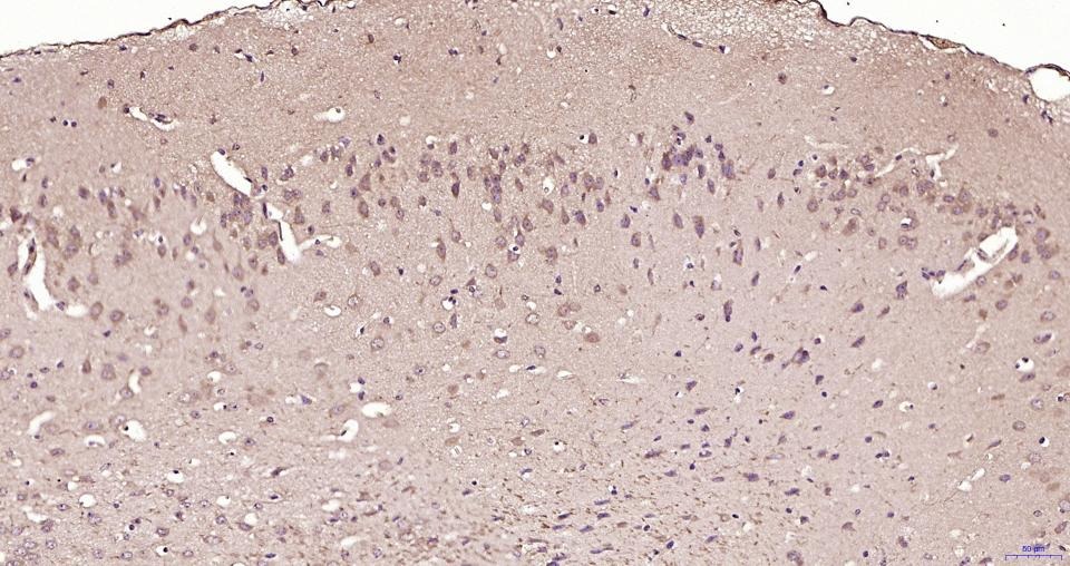 Anti-TBK1 Polyclonal Antibody