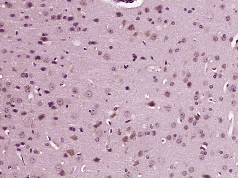 Anti-TRPV1 Polyclonal Antibody 2