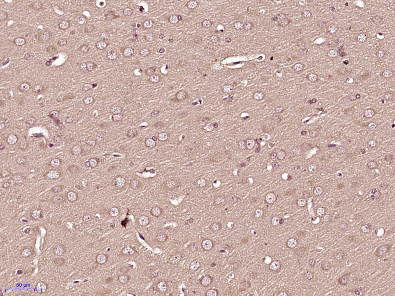 Anti-TRPM3 Polyclonal Antibody