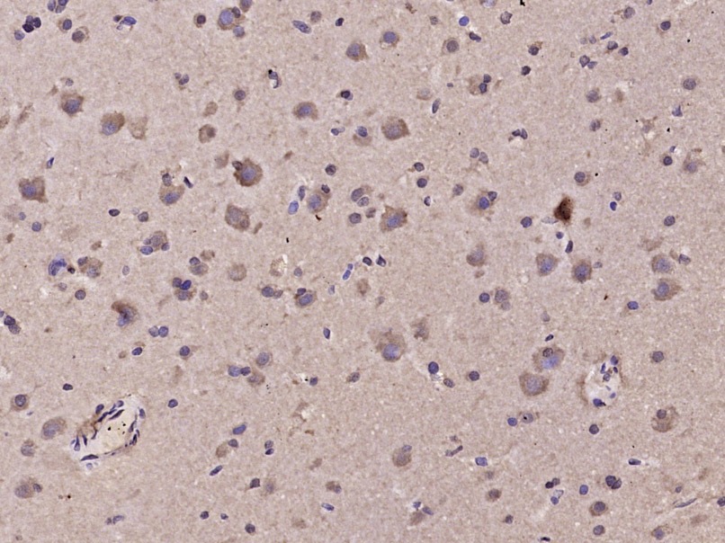 Anti-TRPV4 Polyclonal Antibody