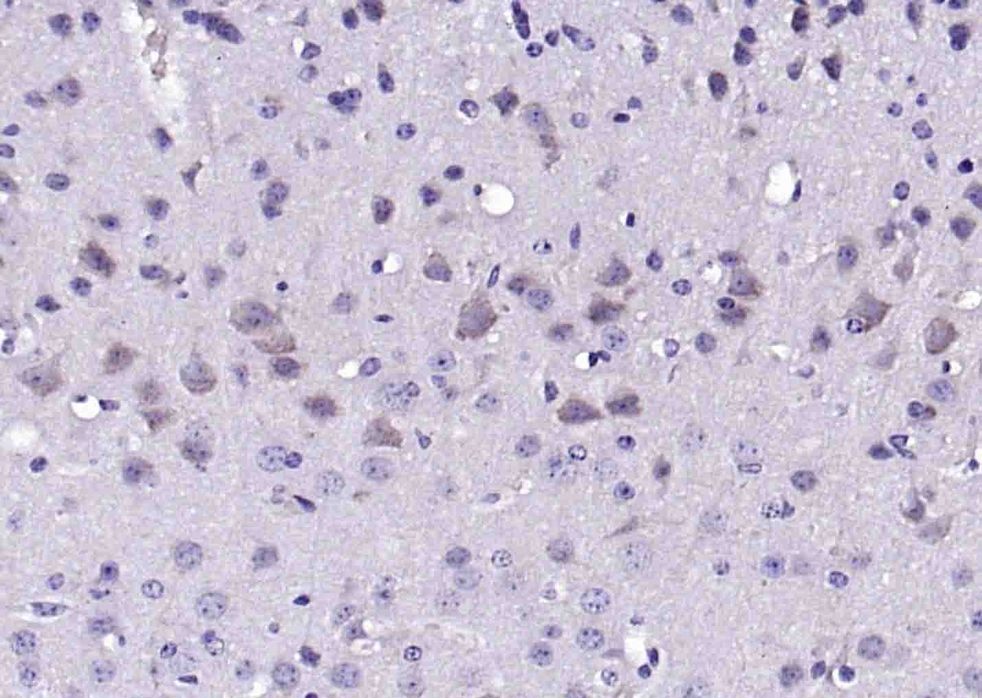 Anti-VAT1L Polyclonal Antibody