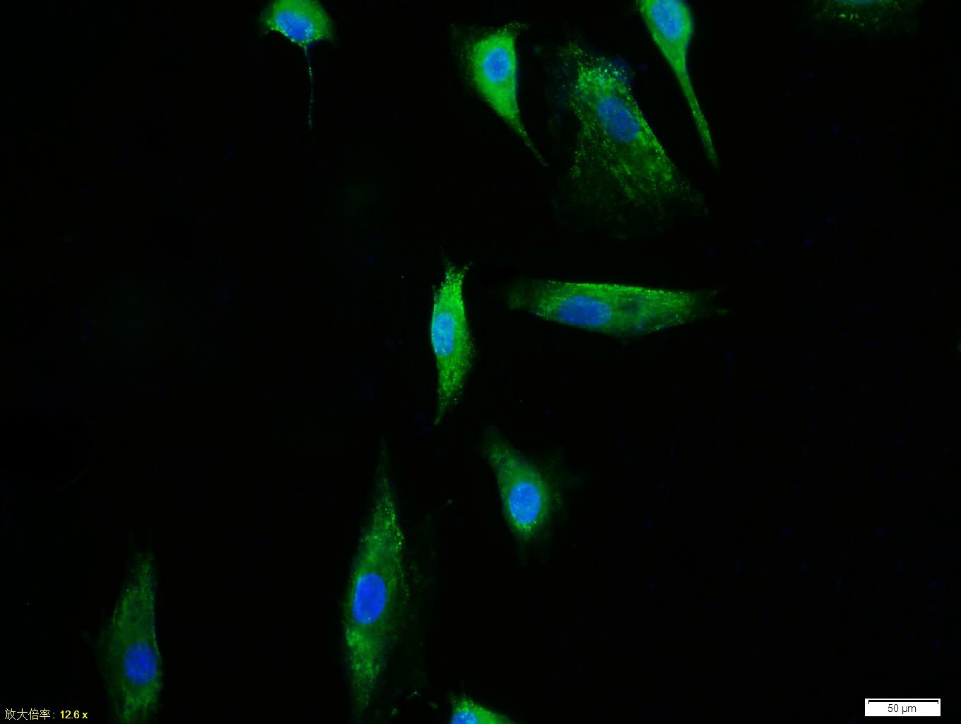 Anti-TERT Polyclonal Antibody
