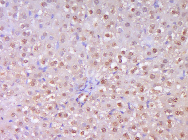 Anti-TERT Polyclonal Antibody