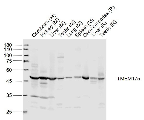 Anti-TMEM175 Polyclonal Antibody