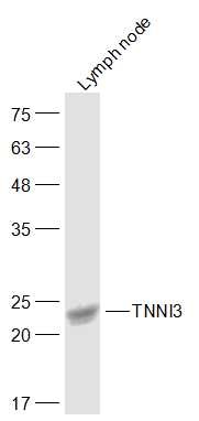 Anti-TNNC1 Polyclonal Antibody