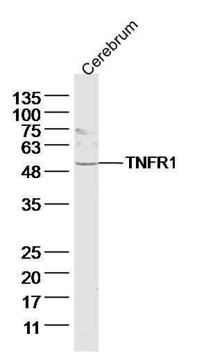 Anti-TNFR1/CD120a/TNFRSF1A Polyclonal Antibody