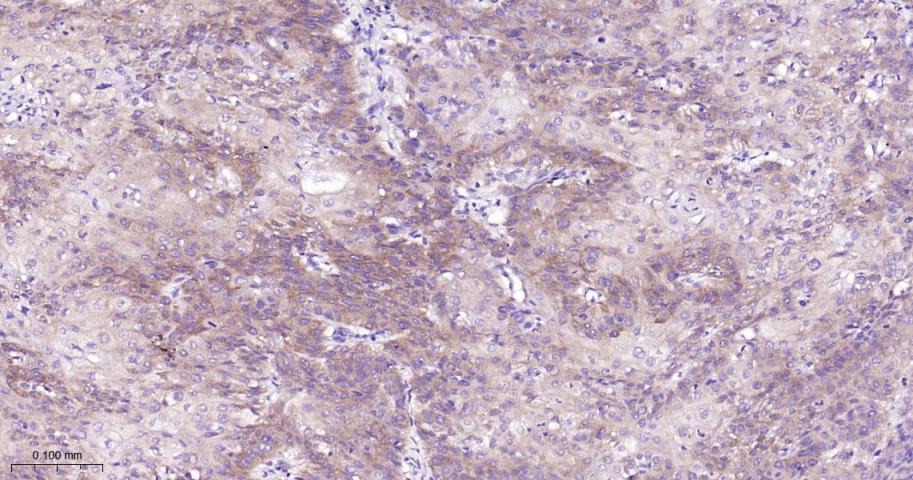 Anti-TNFR2/CD120b/TNFR1B Antibody (1J191)