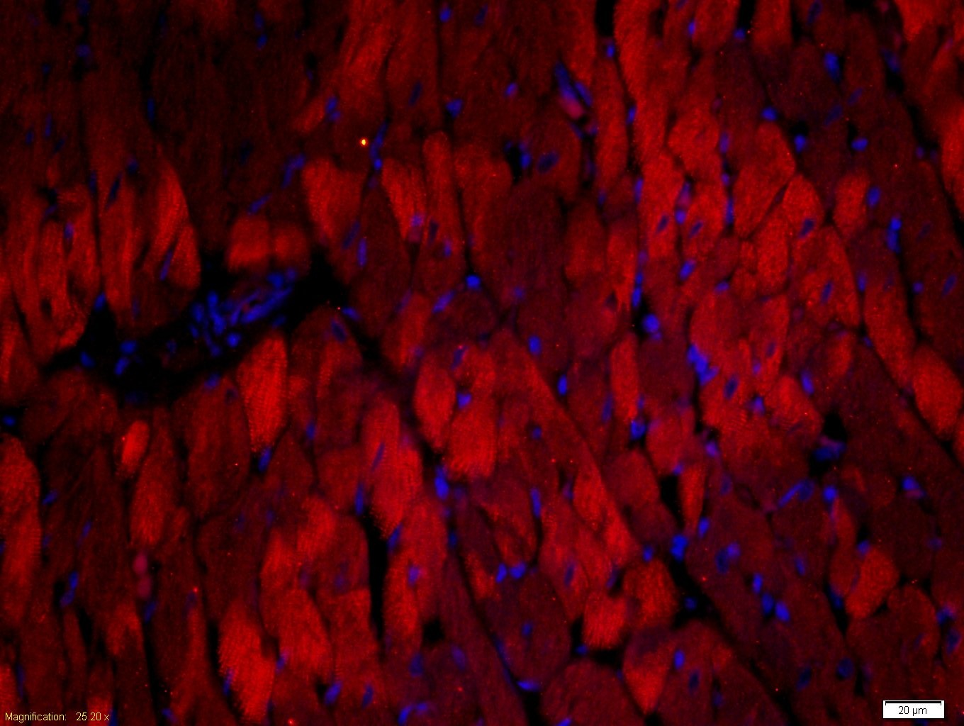 Anti-TnTc Polyclonal Antibody