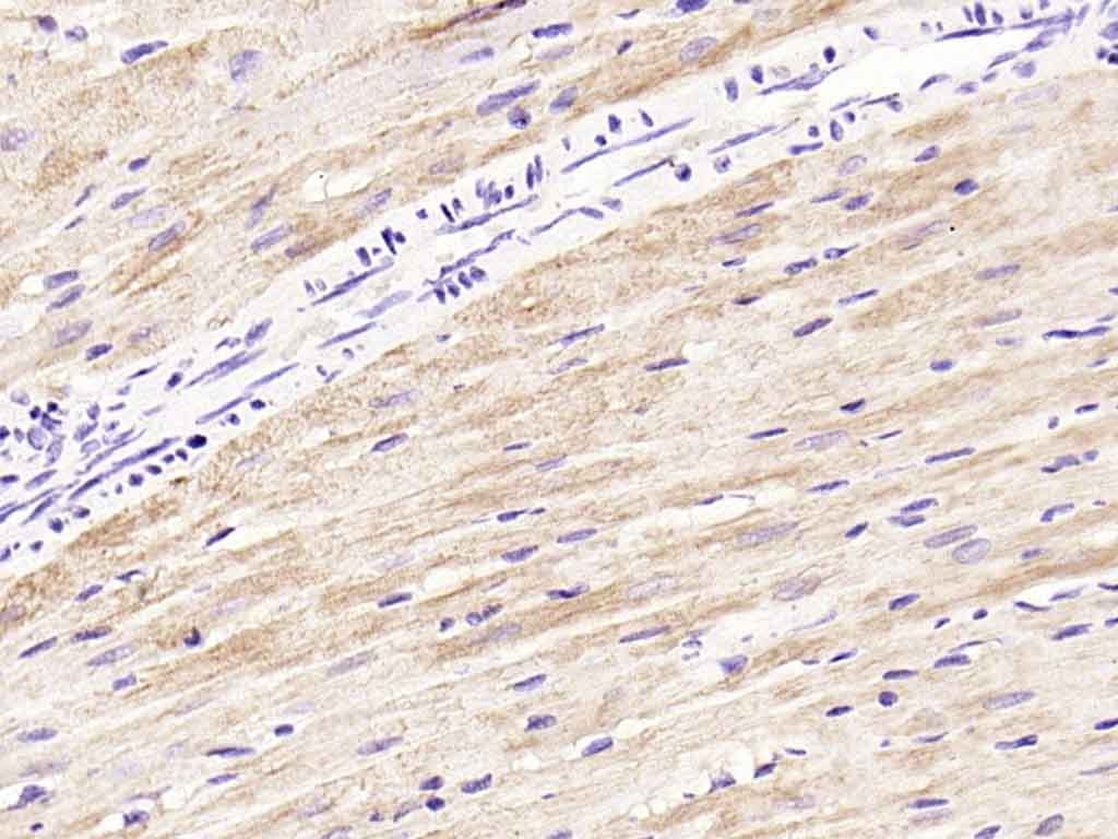 Anti-TNNI3 Polyclonal Antibody