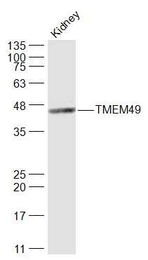 Anti-TMEM49 Polyclonal Antibody