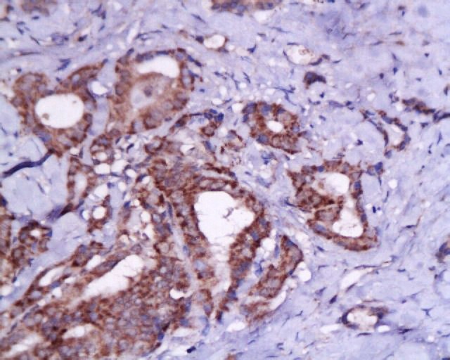 Anti-TSHR (CT) Polyclonal Antibody