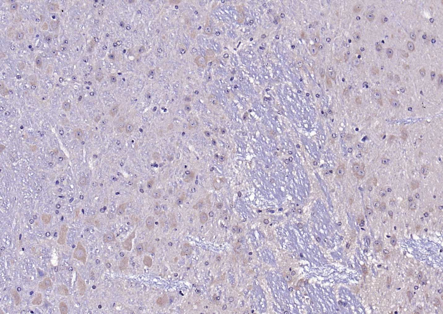 Anti-TRPV1 Polyclonal Antibody