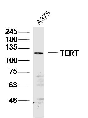Anti-TERT Polyclonal Antibody