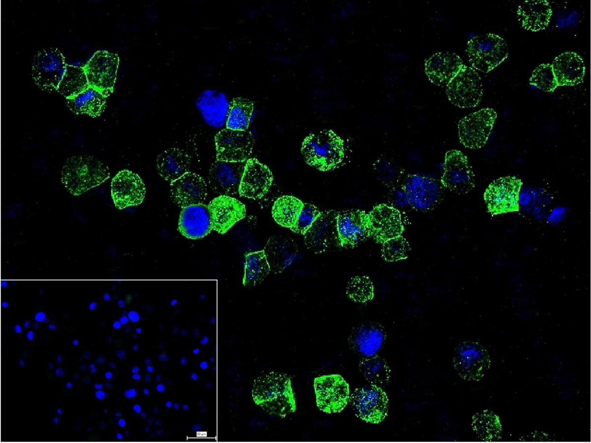 Anti-TNF alpha Polyclonal Antibody 3