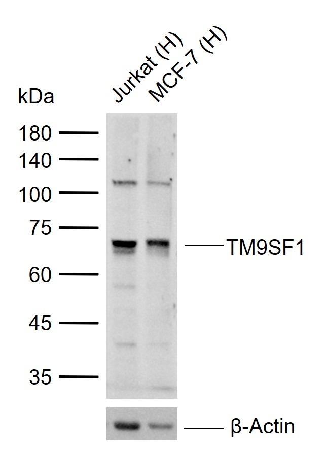 Anti-TM9SF1 Polyclonal Antibody