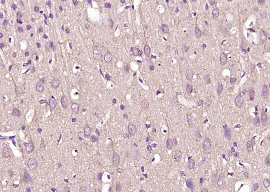 Anti-VAT1L Polyclonal Antibody